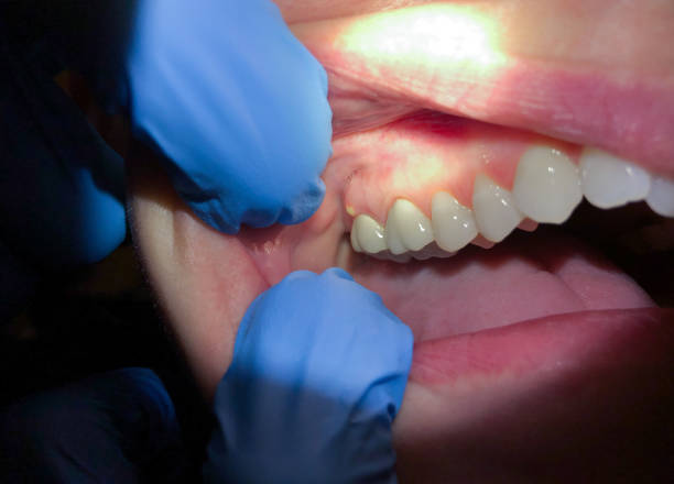 Best Emergency Root Canal Treatment in Olivia, MN
